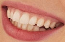 Picture of Coco Rocha teeth and smile