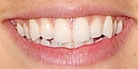 Picture of Cole Sprouse teeth and smile