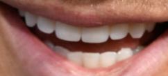 Picture of Colton Underwood teeth and smile