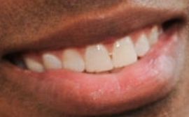 Picture of Corey Hawkins teeth and smile