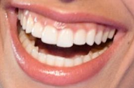Picture of Corinne Foxx teeth and smile
