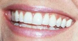 Picture of Courteney Cox teeth and smile
