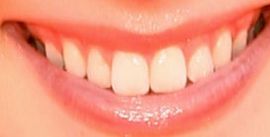 Picture of Courtney Grosbeck teeth and smile