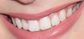Picture of Courtney Grosbeck teeth and smile