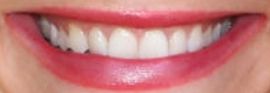 Picture of Courtney Hope teeth and smile