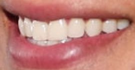 Picture of Daddy Yankee teeth and smile