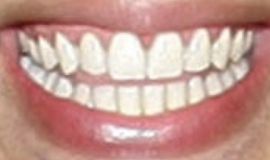 Picture of Daddy Yankee teeth and smile