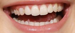 Dakota Fanning's teeth