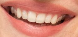 Dakota Johnson's teeth
