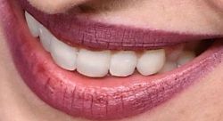 Dakota Johnson's teeth