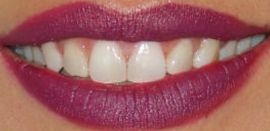 Picture of Danay Garcia teeth and smile