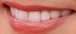 Danica Patrick teeth and smile