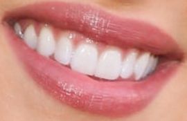 Picture of Daniella Monet teeth and smile