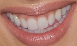 Picture of Daniella Monet teeth and smile
