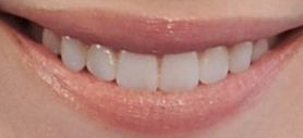 Picture of Danielle Panabaker teeth and smile