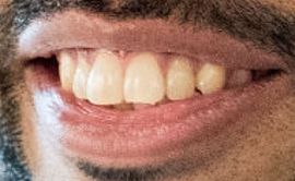 Picture of Daveed Diggs teeth and smile