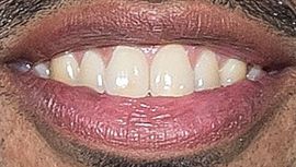 Picture of Daveed Diggs teeth and smile