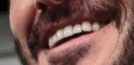Picture of David Beckham teeth and smile