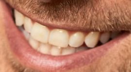 Picture of David Giuntoli teeth and smile