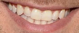 Picture of David Giuntoli teeth and smile