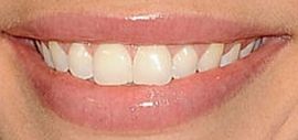 Picture of DeAnna Pappas teeth and smile