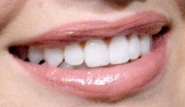 Picture of Debby Ryan teeth and smile