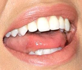 Picture of Debby Ryan teeth and smile