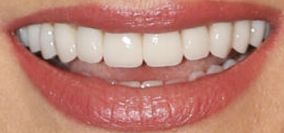 Picture of Debra Messing teeth and smile