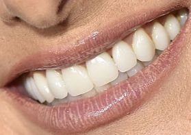 Picture of Debra Messing teeth and smile
