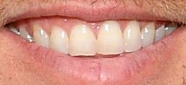 Denny Hamlin's teeth and smile