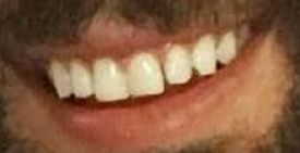 Picture of Derek Peth teeth and smile