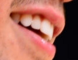 Picture of Devin Booker teeth and smile