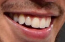 Picture of Devin Booker teeth and smile