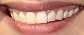 Picture of Dianna Agron teeth and smile