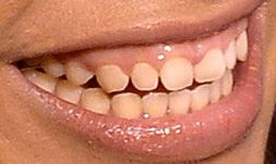 Picture of Dinah Jane teeth and smile