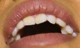 Picture of Dinah Jane teeth and smile