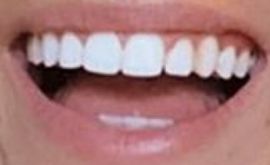 Picture of Dixie D'Amelio teeth and smile