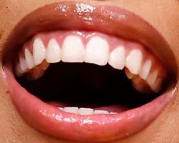 Picture of Doja Cat teeth and smile