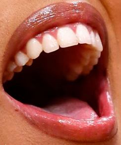 Picture of Doja Cat teeth and smile