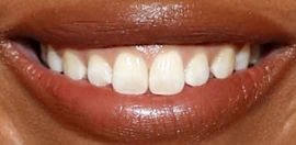 Picture of Dominique Fishback teeth and smile