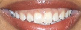 Picture of Dominique Fishback teeth and smile