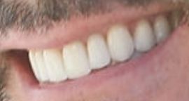 Picture of Don Diamont teeth and smile