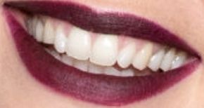 Picture of Doutzen Kroes teeth and smile