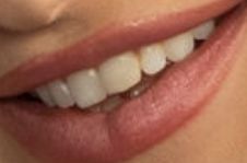 Picture of Dove Cameron teeth and smile