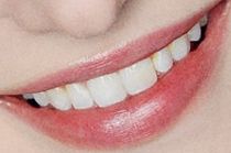 Picture of Dove Cameron teeth and smile