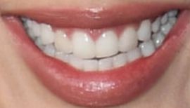 Picture of Eiza Gonzalez teeth and smile