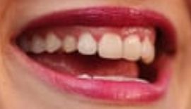Picture of Elisabeth Moss teeth and smile