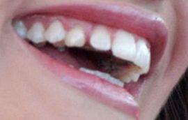 Picture of Elisabeth Moss teeth and smile