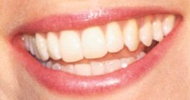 Picture of Elizabeth Banks teeth and smile and smile