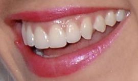 Picture of Elizabeth Hendrickson teeth and smile